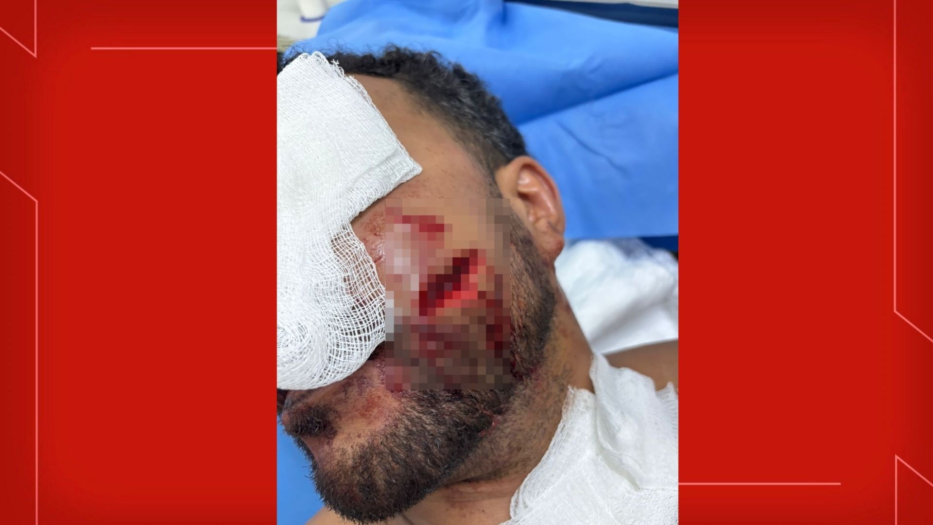 foto Notícia Ceilândia